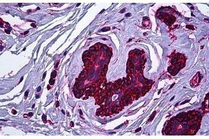 Human Breast: Formalin-Fixed, Paraffin-Embedded (FFPE) (Myosin 9 anticorps)