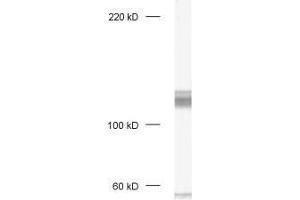 dilution: 1 : 1000, sample: crude synaptosomal fraction of rat brain (P2) (DLG1 anticorps)