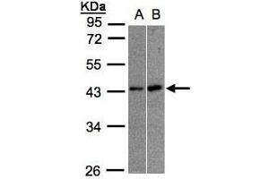 WB Image Sample(30 ug whole cell lysate) A:A431, B:Raji , 10% SDS PAGE antibody diluted at 1:1000 (MBNL3 anticorps)