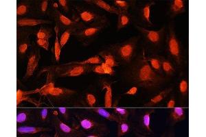 Immunofluorescence analysis of U20S cells using SGOL1 Polyclonal Antibody at dilution of 1:100. (Shugoshin anticorps)
