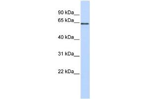 WB Suggested Anti-MAOB Antibody Titration:  0.