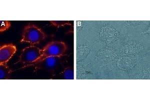 Expression of NR2A in rat C6 glioma cells - Cell surface detection of NR2A in live intact rat C6 glioma cells.