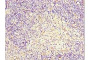 Immunohistochemistry of paraffin-embedded human thymus tissue using ABIN7143883 at dilution of 1:100 (TFCP2 anticorps  (AA 1-280))