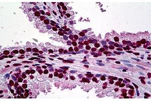 Human Prostate: Formalin-Fixed, Paraffin-Embedded (FFPE) (AFT1 anticorps  (AA 1-272))