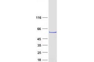 Validation with Western Blot