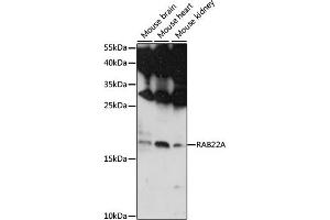 Western blot analysis of extracts of various cell lines, using RA antibody (ABIN7269801) at 1:1000 dilution. (RAB22A anticorps  (AA 1-100))
