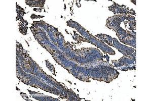 IHC analysis of Astrin/Deepest/SPAG5 using anti-Astrin/Deepest/SPAG5 antibody (ABIN7602399).