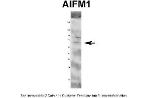 WB Suggested Anti-AIFM1 Antibody Titration: 1 ug/mlPositive Control: Rat tissue (AIF anticorps  (Middle Region))