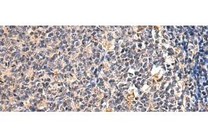 Immunohistochemistry of paraffin-embedded Human tonsil tissue using ENTPD1 Polyclonal Antibody at dilution of 1:60(x200)