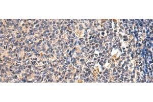 Immunohistochemistry of paraffin-embedded Human tonsil tissue using ENTPD1 Polyclonal Antibody at dilution of 1:60(x200) (CD39 anticorps)