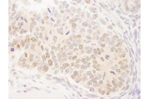 Immunohistochemistry (IHC) image for anti-Mastermind-Like 3 (MAML3) (C-Term) antibody (ABIN7448637)