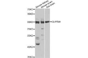 Western blot analysis of extracts of various cell lines, using CLPTM1 Antibody. (CLPTM1 anticorps)