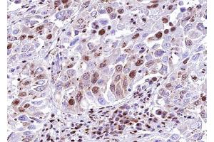 ABIN6268706 at 1/100 staining human lung tissue sections by IHC-P. (SMAD6 anticorps  (Internal Region))