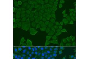 Immunofluorescence analysis of U2OS cells using REEP1 Polyclonal Antibody at dilution of 1:100. (Receptor Accessory Protein 1 anticorps)