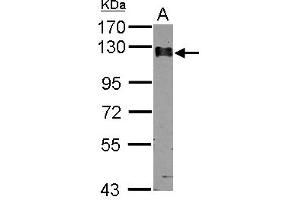 Western Blotting (WB) image for anti-Calpastatin (CAST) (AA 275-700) antibody (ABIN1497106) (Calpastatin anticorps  (AA 275-700))