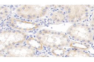 Detection of TNFb in Human Kidney Tissue using Monoclonal Antibody to Tumor Necrosis Factor Beta (TNFb) (LTA anticorps  (AA 36-205))