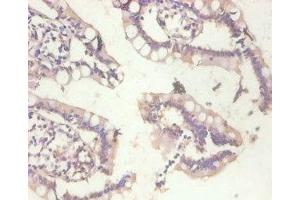 Immunohistochemistry of paraffin-embedded human small intestine tissue using ABIN7159509 at dilution of 1:100 (MT1A anticorps  (AA 1-59))
