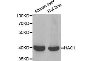 Western blot analysis of extracts of various cell lines, using HAO1 antibody (ABIN5973868) at 1/1000 dilution. (HAO1 anticorps)