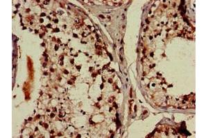 Immunohistochemistry of paraffin-embedded human testis tissue using ABIN7164355 at dilution of 1:100 (DDX4 anticorps  (AA 1-223))