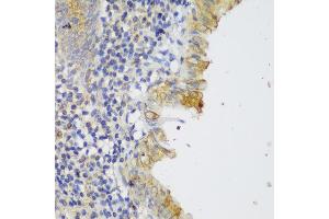 Immunohistochemistry of paraffin-embedded human appendix using GCC2 antibody (ABIN6130422, ABIN6141007, ABIN6141008 and ABIN6217941) at dilution of 1:150 (40x lens). (GCC2 anticorps  (AA 1-300))
