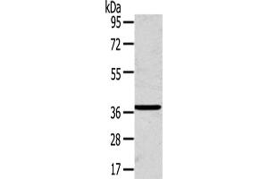 Gel: 8 % SDS-PAGE,Lysate: 40 μg,Primary antibody: ABIN7192440(SLC25A20 Antibody) at dilution 1/200 dilution,Secondary antibody: Goat anti rabbit IgG at 1/8000 dilution,Exposure time: 1 minute (SLC25A2 anticorps)