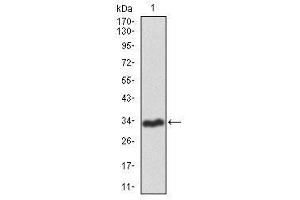 Image no. 1 for anti-Recombination Activating Gene 1 (RAG1) antibody (ABIN1491682)