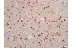 Formalin-fixed and paraffin embedded rat brain labeled with Rabbit Anti Jarid2/Jumonji Polyclonal Antibody, Unconjugated (ABIN1386206) at 1:200 followed by conjugation to the secondary antibody and DAB staining (JARID2 anticorps  (AA 301-400))