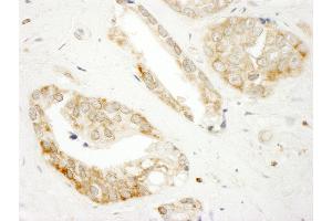 Immunohistochemistry (IHC) image for anti-Dedicator of Cytokinesis 4 (DOCK4) (AA 1725-1775) antibody (ABIN7448952)