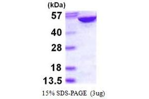 Adenylosuccinate Lyase (ADSL) (AA 1-484) protein (His tag)