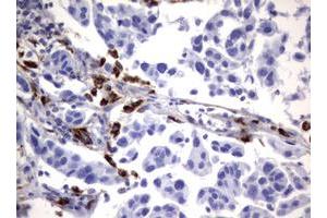 Image no. 3 for anti-Sialidase 1 (Lysosomal Sialidase) (NEU1) (AA 48-315) antibody (ABIN1491548)