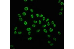 anti-RNA Polymerase II Subunit RPB1 (POLR2A) (pSer5) antibody