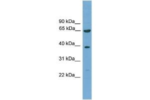 WB Suggested Anti-KLHL20 Antibody Titration: 0. (KLHL20 anticorps  (C-Term))