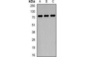 Western blot analysis of TCF4 expression in HepG2 (A), MCF7 (B), mouse brain (C) whole cell lysates. (TCF4 anticorps)