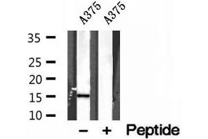 Western blot analysis of extracts of A375 cells, using FABP5 antibody. (FABP5 anticorps  (Internal Region))