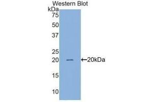 Detection of Recombinant Surv, Human using Monoclonal Antibody to Survivin (Surv) (Survivin anticorps  (AA 1-142))