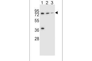 Western blot analysis in NCI-H460(lane 1),HepG2(lane 2),ZR-75-1(lane 3) cell line lysates (35ug/lane). (UGT2B15 anticorps  (AA 156-185))