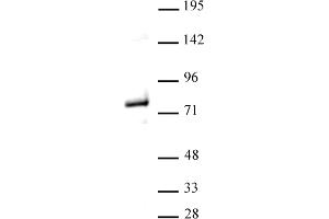 Western blot of Menin antibody. (Menin anticorps  (C-Term))