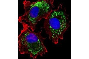 Fluorescent image of MCF-7 cells stained with ALDH6A1 Antibody (ABIN659006 and ABIN2838041).