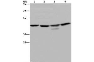 Western Blot analysis of K562 and 293T cell, Jurkat cell and Mouse brain tissue using CSNK2A1 Polyclonal Antibody at dilution of 1:300 (CSNK2A1/CK II alpha anticorps)