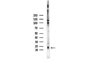 anti-Fibroblast Growth Factor 22 (FGF22) (Internal Region) antibody