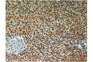 Immunohistochemistry (Paraffin-embedded Sections) (IHC (p)) image for anti-TRAF Interacting Protein (TRAIP) (C-Term) antibody (ABIN783910) (TRAIP anticorps  (C-Term))