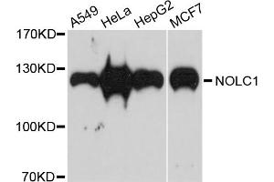 Western blot analysis of extracts of various cell lines, using NOLC1 antibody. (NOLC1 anticorps)