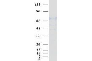 Validation with Western Blot