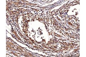 IHC analysis of ENO1 using anti-ENO1 antibody (ABIN7601902). (ENO1 anticorps  (AA 50-250))