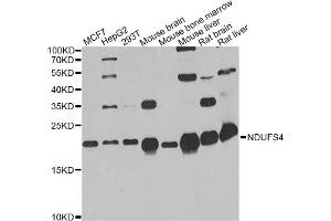 Western blot analysis of extracts of various cell lines, using NDUFS4 antibody. (NDUFS4 anticorps)