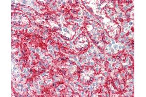 Anti-HLA-A antibody IHC staining of human spleen.