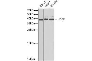Western blot analysis of extracts of various cell lines, using HDGF antibody  at 1:1000 dilution.