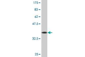 Western Blot detection against Immunogen (36. (ZNF71 anticorps  (AA 1-100))