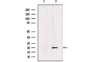 Western blot analysis of extracts from 293, using BTC Antibody. (Betacellulin anticorps  (N-Term))