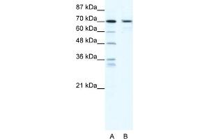 WB Suggested Anti-PRDM1 Antibody Titration:  2. (PRDM1 anticorps  (N-Term))